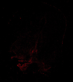 13PCW human midbrain